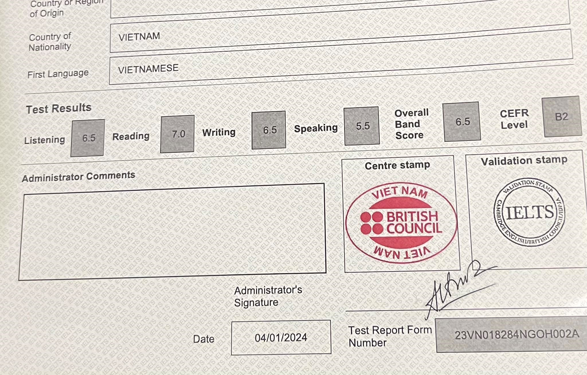 NHÌN ĐIỂM IELTS BẮT BỆNH VÀ CÁCH CHỮA